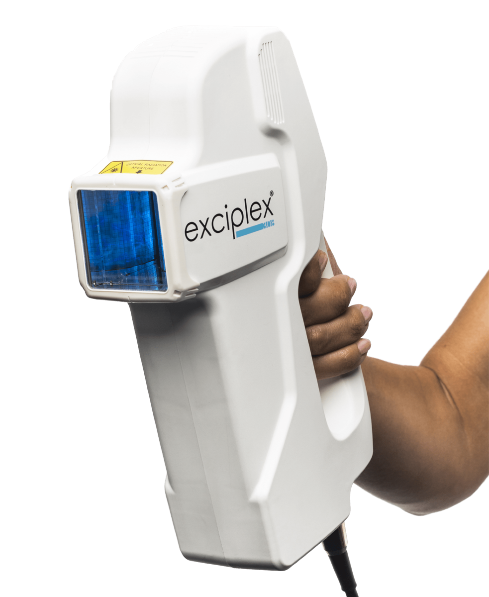 Exciplex Excimer